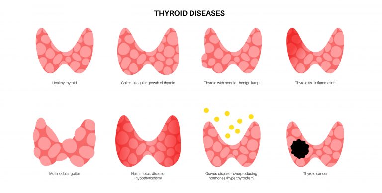 Thyroid Disorders | Mr Robert Hone, ENT Surgeon | One Ashford Hospital